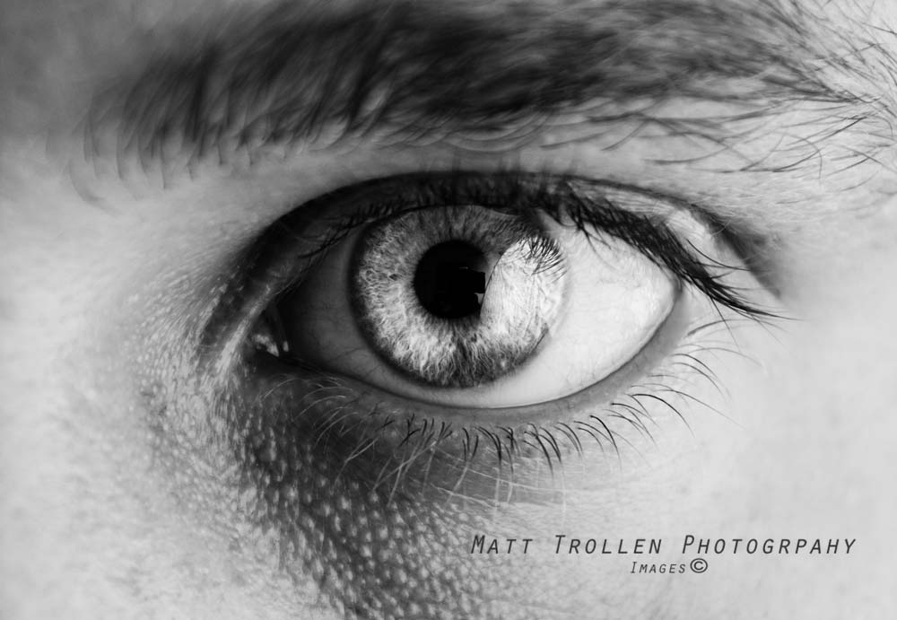 Diabetic Retinopathy and LED Lighting Sunlite Science Diabetic Retinopathy and LED Lighting Sunlite Science
